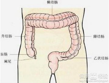 结肠炎会癌变吗为什么结肠炎总是用药有效、停药复发