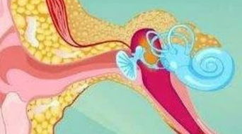 中耳炎是什么 为什么会得中耳炎呢