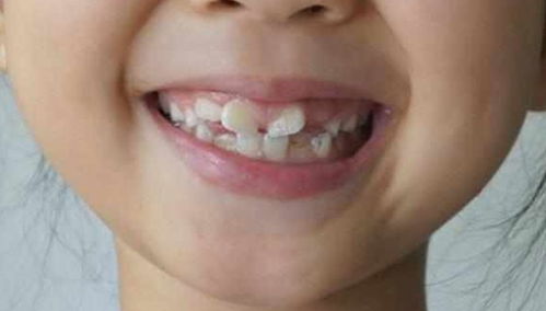 孩子换牙期,一定要及时吃这些食物,避免牙齿长歪,牙齿整齐漂亮