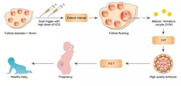 匡延平团队率先发现LHCGR基因突变女性不孕症患者IVF ET治疗策略