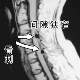 骨科中的 拍片 ,你选对了吗