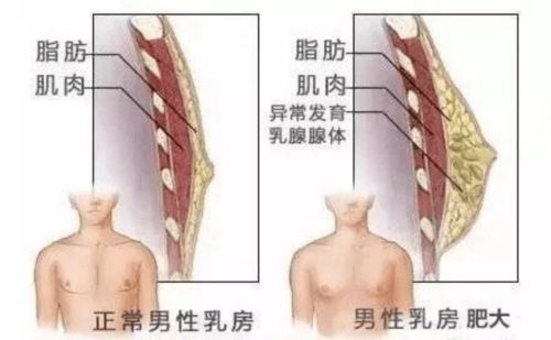 男人也会长 大咪咪