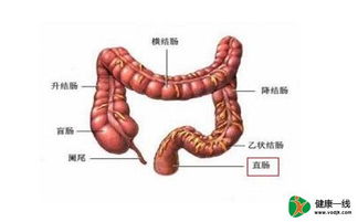 晚期直肠癌会有哪些症状 直肠癌的晚期表现有什么