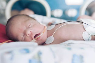 袋鼠包 拯救28周早产宝宝 比保温箱还靠谱的护理你一定要知道
